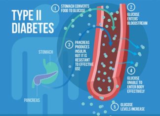 Patients with Type 2 diabetes who were treated with the newer generation of insulin analog drugs did not have substantially better outcomes than those treated with less costly human insulin