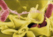 Depression and anxiety in obesity : Gut microbes may contribute