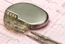 Micropacemaker may open up new cardiac pacing options for children and adults