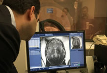 A handful of Alzheimer’s patients signed up for a bold experiment: They let scientists beam sound waves into the brain to temporarily jiggle an opening in its protective shield