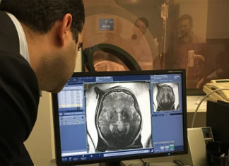 A handful of Alzheimer’s patients signed up for a bold experiment: They let scientists beam sound waves into the brain to temporarily jiggle an opening in its protective shield