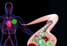 A magnetic wire used to snag scarce and hard-to-capture tumor cells could prove to be a swift and effective tactic for early cancer detection