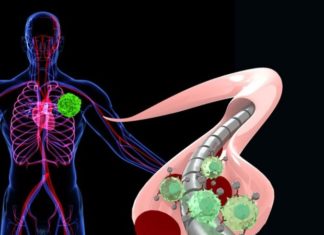 A magnetic wire used to snag scarce and hard-to-capture tumor cells could prove to be a swift and effective tactic for early cancer detection