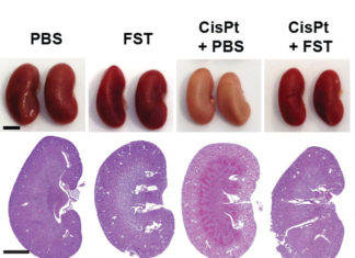 A naturally occurring hormone could help make chemotherapy much more effective