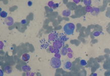 A new preclinical candidate drug with the potential to treat visceral leishmaniasis