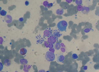 A new preclinical candidate drug with the potential to treat visceral leishmaniasis