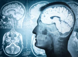 Brain tumour chemotherapy now available to even more NHS patients