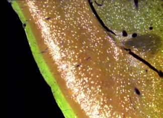 Can you tell the smell of a rose from the scent of a lilac? If so, you have your brain’s piriform cortex to thank