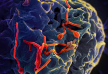 Ebola survivors : key immune system cells – Scientists made a surprising discovery that provides important clues to developing effective vaccines against the infection