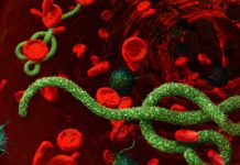 Ebola survivors suffer from severe neurological problems