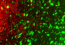 Engineered cancer cells can fight primary and metastatic cancer