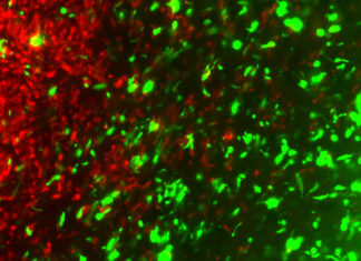 Engineered cancer cells can fight primary and metastatic cancer