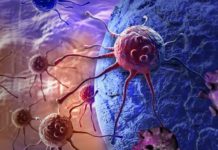 How obesity drives colon cancer