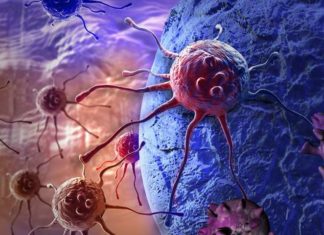 How obesity drives colon cancer