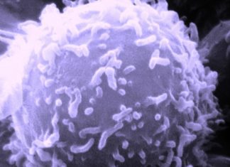How targeting metabolism can defeat cancer stem cells