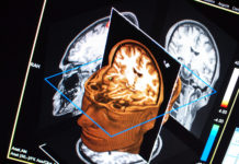 IQ : Scientists can predict intelligence from brain scans