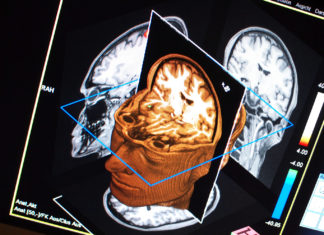 IQ : Scientists can predict intelligence from brain scans