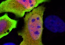 Identified a new gene that plays a critical role in regulating the body’s immune response to infection and disease.
