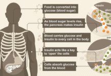 Just two weeks without activity can trigger diabetic symptoms in vulnerable patients