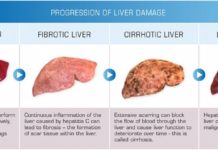 Liver cancer : The newly discovered ‘switch’ controls the activity of two proteins and improve future therapies
