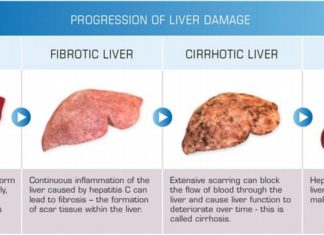 Liver cancer : The newly discovered ‘switch’ controls the activity of two proteins and improve future therapies