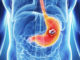 New marker for favourable prognosis in gastric and esophageal cancer