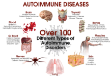 Link between a number of autoimmune diseases and an increased risk of developing psychosis