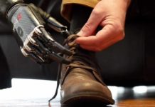 Researchers from the University of Salford have used new techniques to show that people with artificial arms and hands are doing damage to their intact limbs