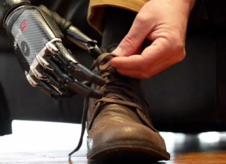 Researchers from the University of Salford have used new techniques to show that people with artificial arms and hands are doing damage to their intact limbs