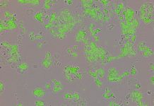 Scientists have unveiled clues about a mysterious molecule called Yin Yang1 – and revealed it may fuel tumour growth in breast cancer.