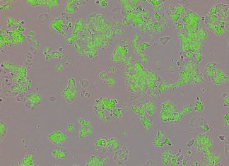 Scientists have unveiled clues about a mysterious molecule called Yin Yang1 – and revealed it may fuel tumour growth in breast cancer.