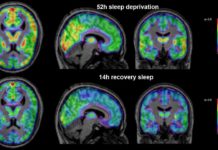 Sleep is an autonomic process and is not always under our direct, voluntary control
