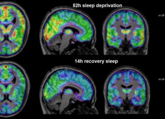 Sleep is an autonomic process and is not always under our direct, voluntary control