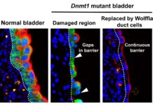 The bladder is a master at self-repair – When damaged by infection or injury, the organ can mend itself quickly