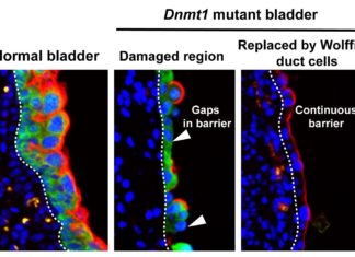 The bladder is a master at self-repair – When damaged by infection or injury, the organ can mend itself quickly