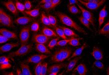 The components of the immune system that trigger allergic reactions may also help protect the skin against cancer