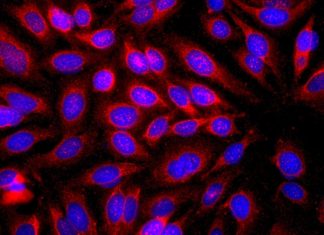 The components of the immune system that trigger allergic reactions may also help protect the skin against cancer