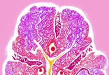 The immune system can be an important ally in the fight against cancer