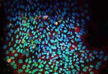 The therapeutic potential of human induced pluripotent stem cells