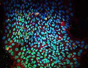 The therapeutic potential of human induced pluripotent stem cells