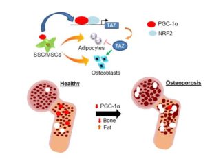Researchers discover gene that controls bone-to-fat ratio in bone marrow
