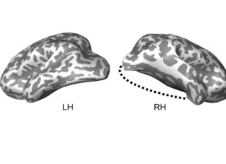 A new study led by Carnegie Mellon University neuroscientists provides the first evidence of how the human brain recovers the ability to function after losing parts of the visual system