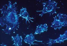 Ketogenic diet may boost targeted cancer therapy