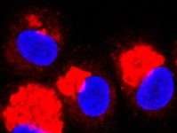 Natural lipid acts as potent anti-inflammatory