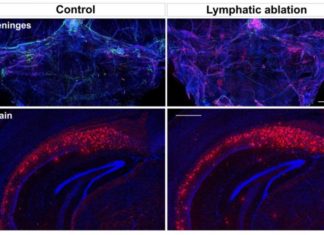 Aging vessels connecting the brain and the immune system play critical roles in both Alzheimer’s disease and the decline in cognitive ability that comes with time