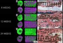 3D-printed implants chemically coated, ceramic implants successfully guided the regrowth of missing bone
