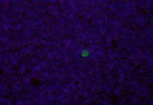 University of Copenhagen have discovered a method of diagnosing a broad range of cancers at their early stages by utilising a particular malaria protein