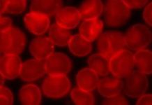 A team of researchers from several institutions in Iceland and the U.S. has conducted a unique blood serum investigation and discovered multiple protein networks that are involved in the aging process