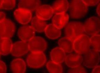 A team of researchers from several institutions in Iceland and the U.S. has conducted a unique blood serum investigation and discovered multiple protein networks that are involved in the aging process