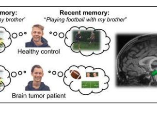 Children with certain types of brain tumors who undergo radiation treatment are less likely to recall the specifics of events they experienced after radiation than to remember pre-treatment happenings